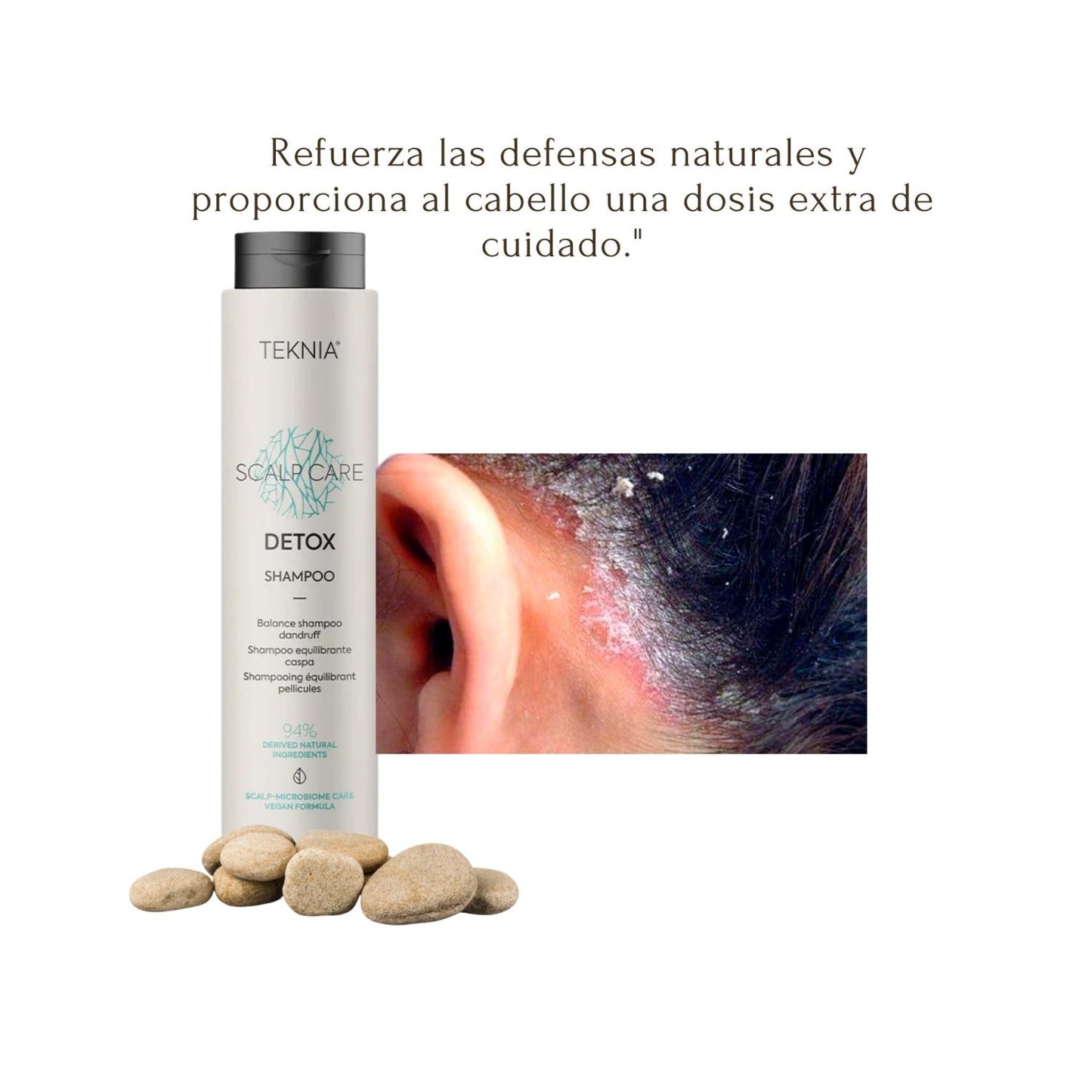 Shampoo  Detox Lakme Teknia 300ml Combate Caspa Suaviza Calmante